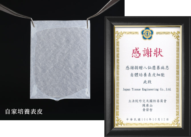 台湾への自家培養表皮の提供
