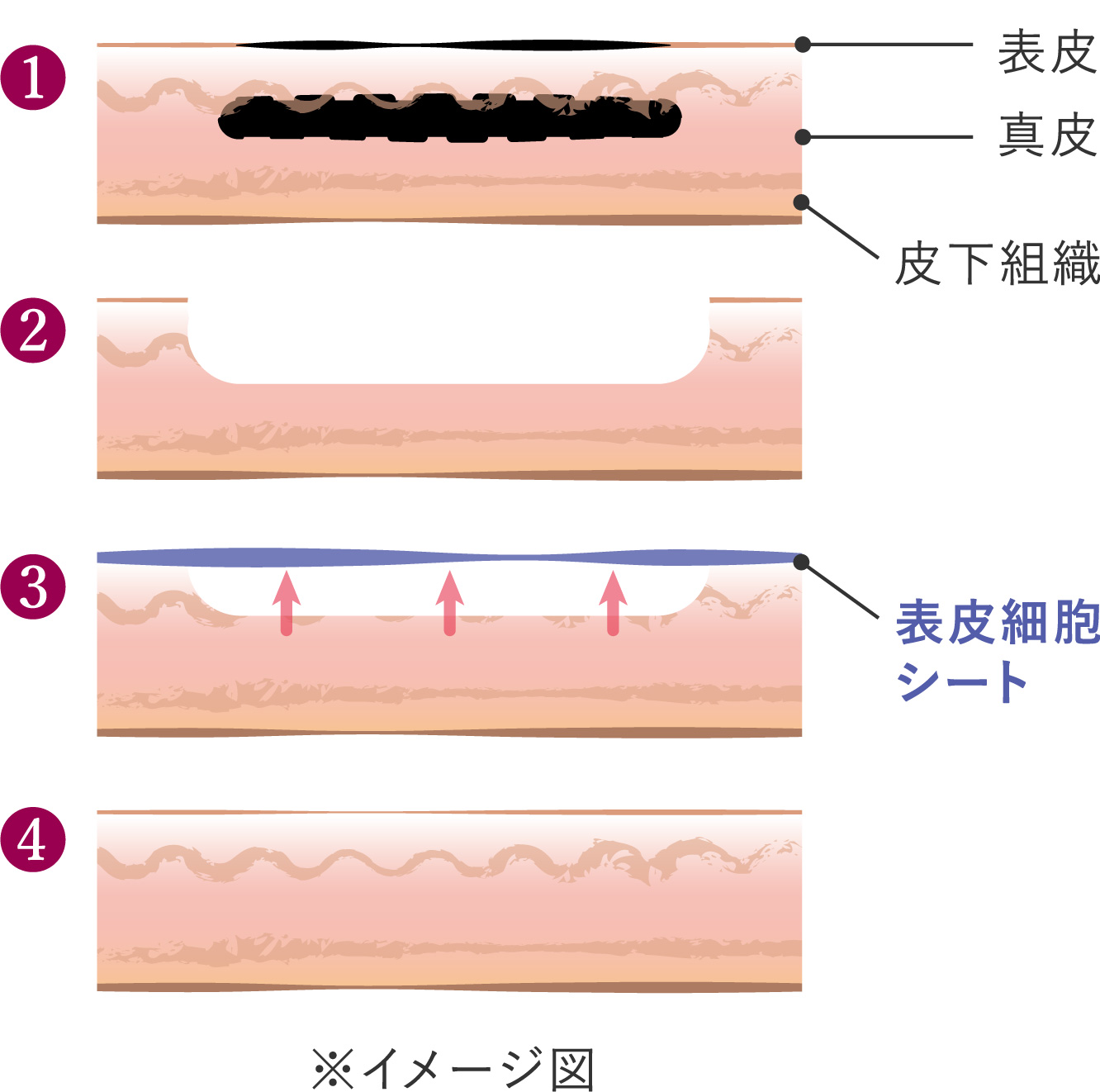 皮膚の構造