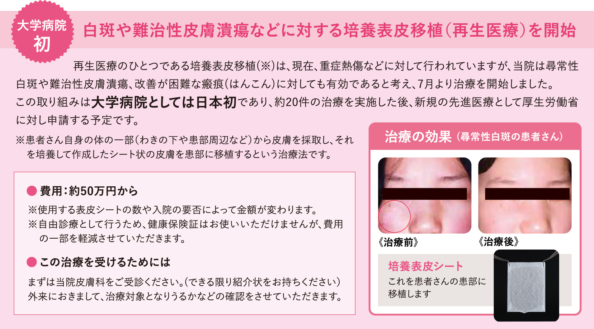 白斑とは何か、原因、症状、治療法